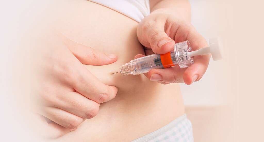 试管婴儿移植后做好 11 点 提高着床率