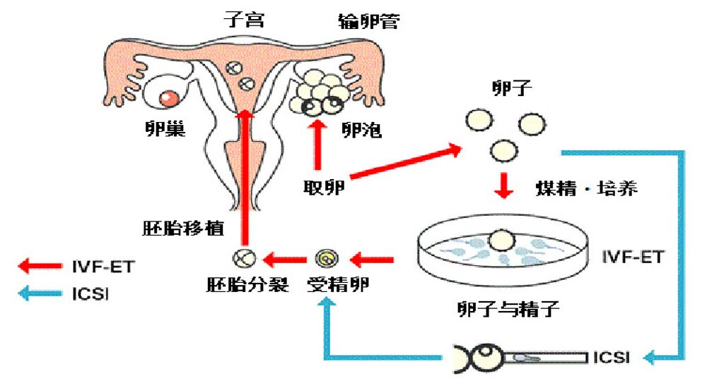 广州代孕机构：我的“幸孕”不是“奇迹”